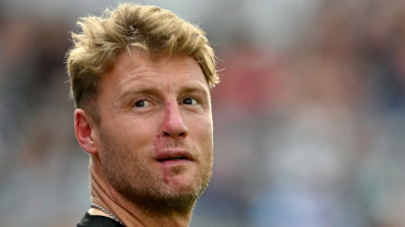 Andrew Flintoff: Cricket ‘saved me’ after Top Gear crash